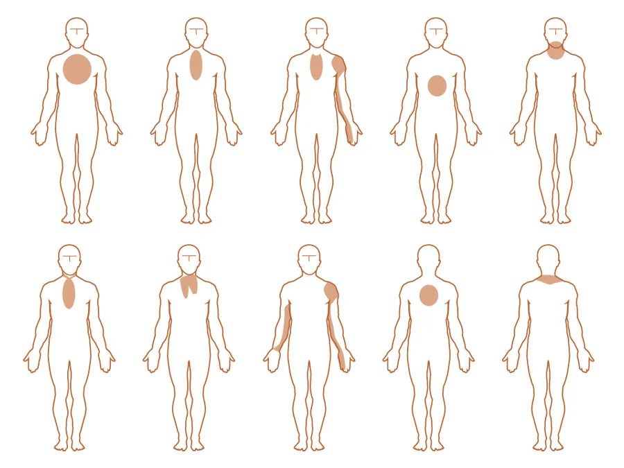 diagram depicting various locations on the human body angina discomfort can occur